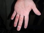 2009_0422NJRocksJessesBattleWounds.JPG