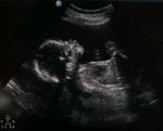 2010-09-09 BjornsProfile.jpg